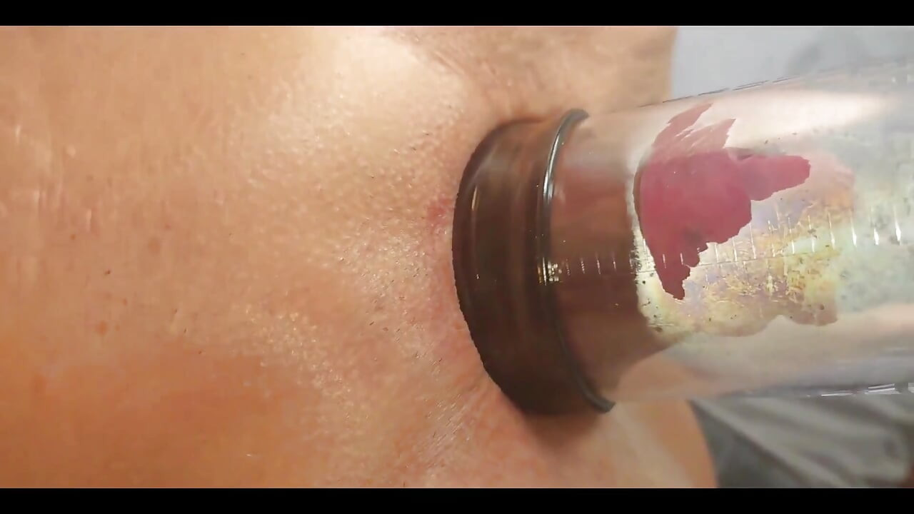 진공 펌프로 내 보지를 존나게 만들고 파열