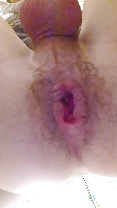 Working hard on my prolapse