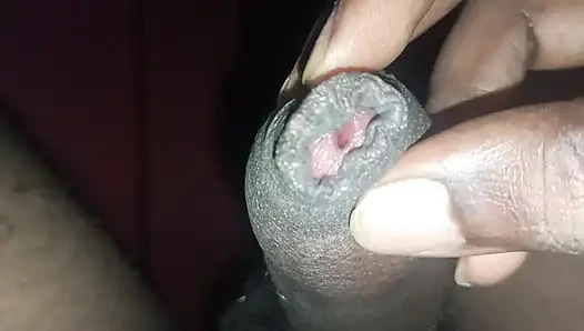 Yarak yakın çekim