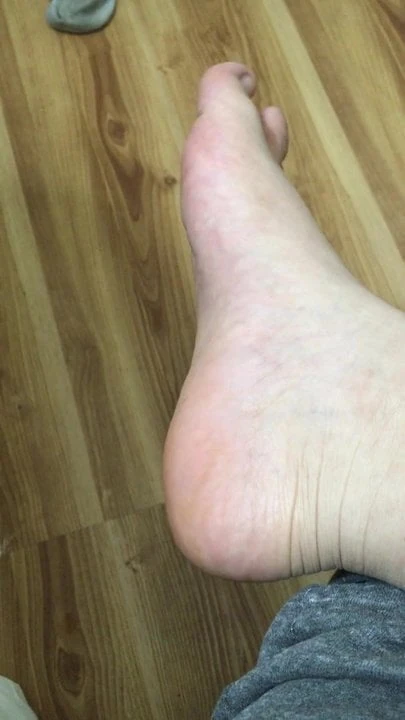 19 year old male feet