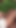 Jaw-dropping moment from "Outdoor interracial lesbian sex in a forest between a skinny ebony chick and a brunette with big tits"