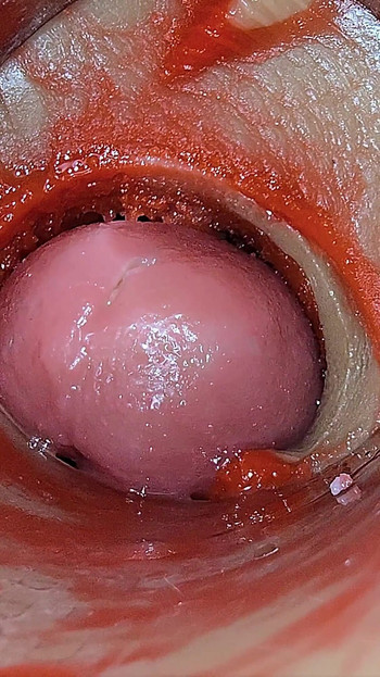 Kamera Unutar Duboke Pičke Snima Predoziranje Ejakulacija Sperme Asmr