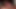 Mature woman has anal sex with young teenager man