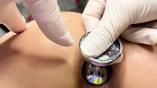 Ich habe den anus meiner ehefrau auf 4cm vergrößert
