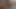 Lizzy Yum VR April 2023 #4 post op orgasm pussy masturbation teasing orgasm toys