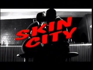 Skin City