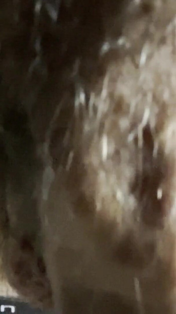 Zapanjujući trenutak iz "Penis Veins, Hair & Head"