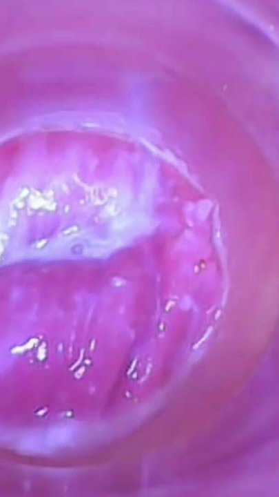 Lewd Wife: Observation, Close-Up Shots, Clitoral Magnification, Full View Inside the | Clip 3