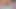 Masturbation Pat 3 / 3 Can you tell me the solution, how can I solve this problem?
