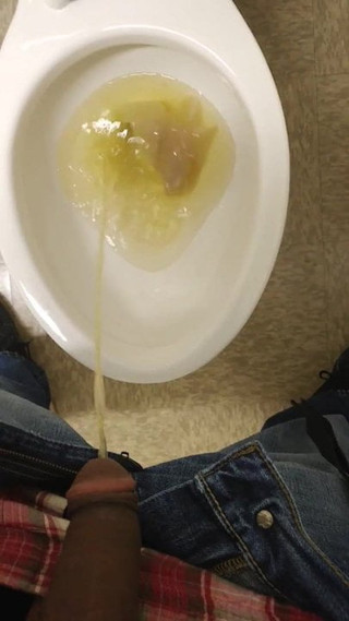 Pee Test