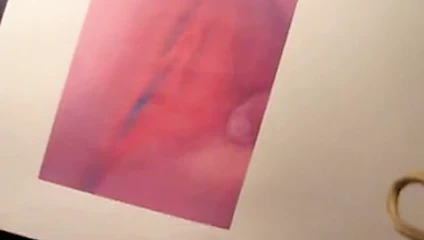 abgespritzt