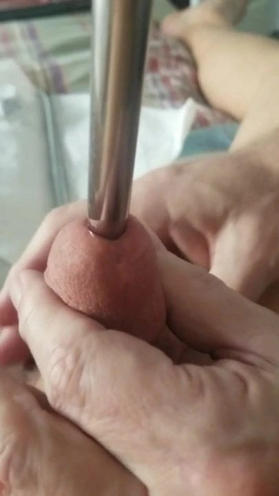 Peregangan uretra