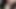 クイック1