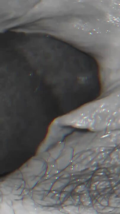 Letakkan Dalam Kedua-dua Lubang