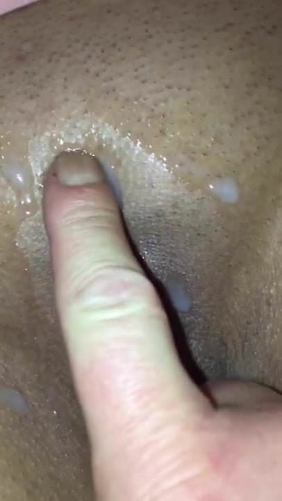 Spermafotze