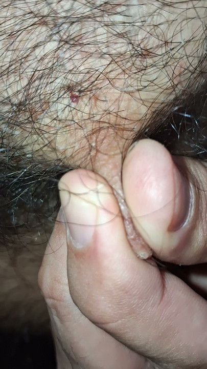 Hairy nipples in the foreground