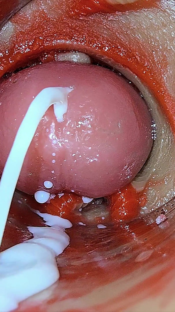 Kamera Unutar Duboke Pičke Snima Predoziranje Ejakulacija Sperme Asmr