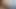 Massive Cumshot in My Wifes Mouth
