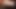 Big penis enlargement 5mints sex for not passs sex hot new for me to get the channel of communication accounts