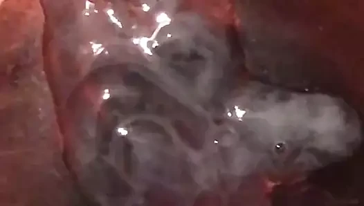 Döl boşalması