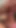 Quick teaser 2