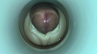 Babybeslag door sperma cam man