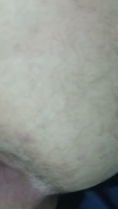 Femboy showing off his red ass on the internet