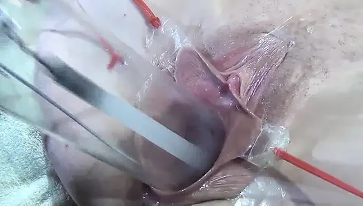 10 Weit Gespreizte Muschi Nahaufnahme Fickt Mit Lampe 1000 Watt