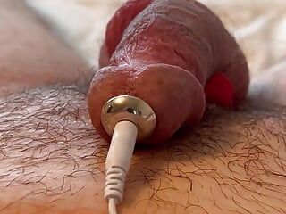 Electrojaculación de próstata estimulación