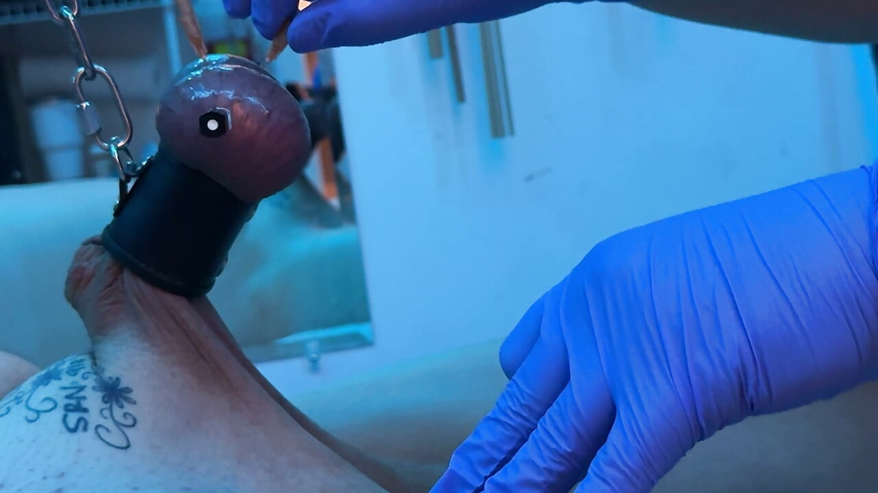Nadelorgasmus