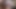 extreme close up of my ugly and dirty cock with castrated testicle PART 2