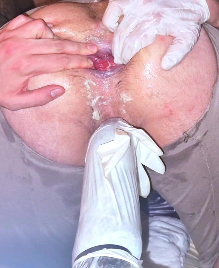 Big virgin ass gaping with big anal dildo