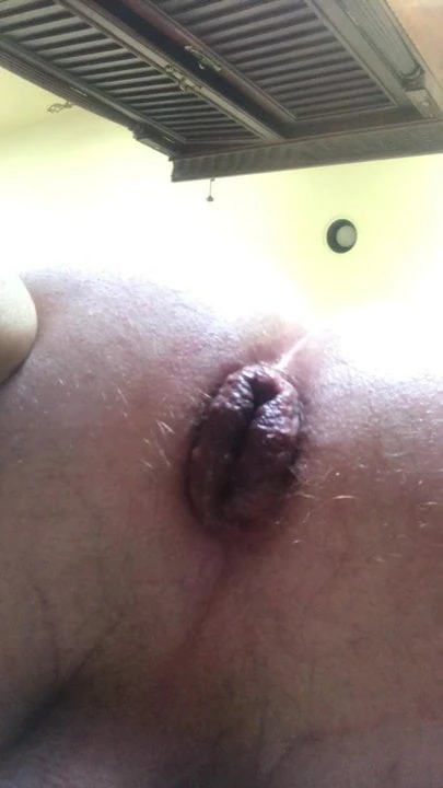 Plug abuse