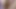 Monster Hairy Pussy Masturbation Huge Clitoris