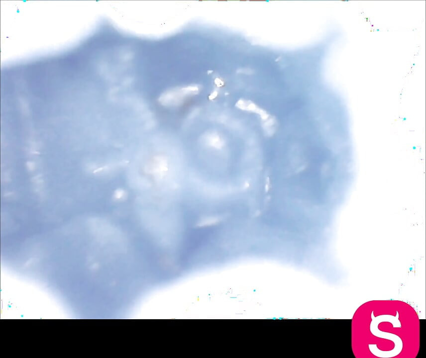 Endoscope Lens Captures Unbearable Pleasure