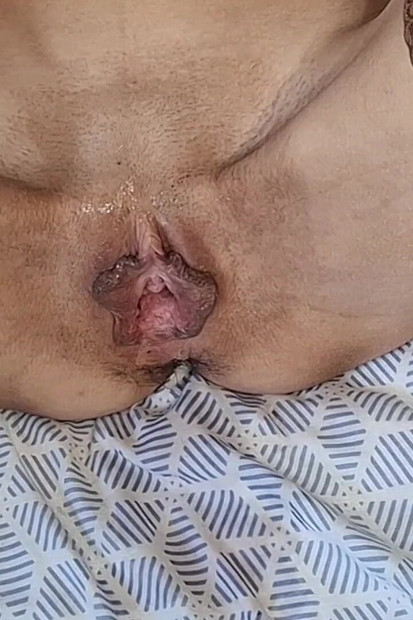 18-year-old Skinny Teen Takes Extreme Fisting, Her Whole Hand in Her Pussy