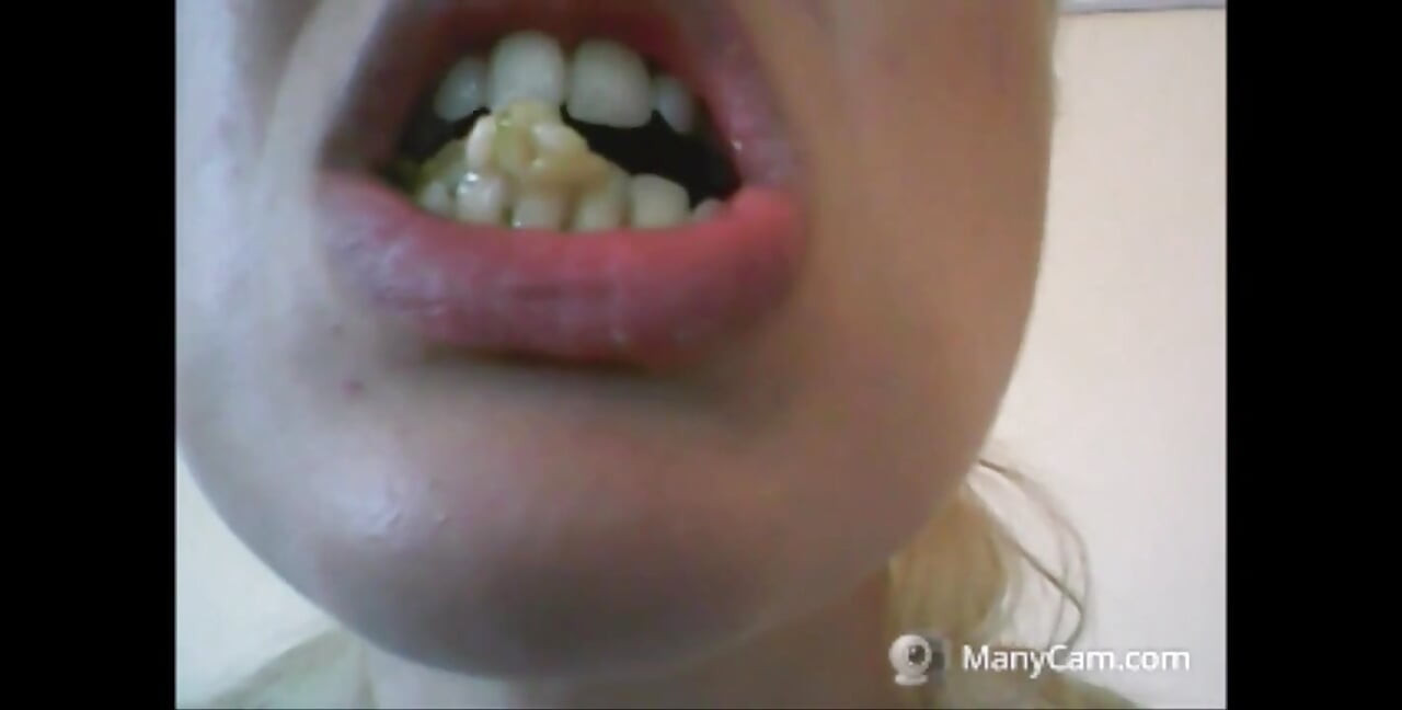 Chantals zähne fallen auseinander, rotten und schwarz