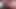Extreme urethral sounding. Multiple cock sounding