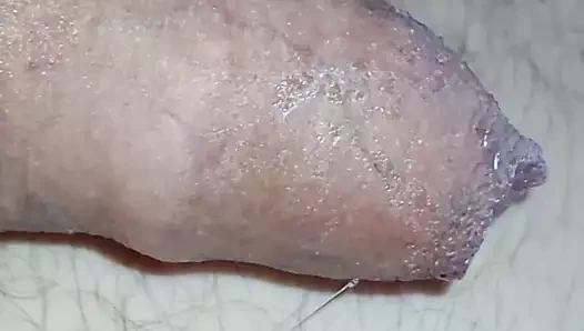 Sünnetsiz küçük yarak boşalması