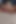 While She Was Massaging Her Eyes, Her Lover Husband Gave Her Wonderful Sex!