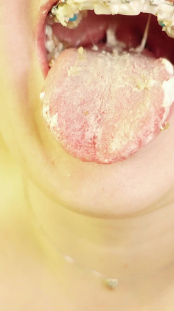 Key moment from "eating in braces - vore and food fetish - close up video"