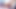 Interracial Anal: 30cm Black Cock in Tight White Ass - Extreme Contrasts