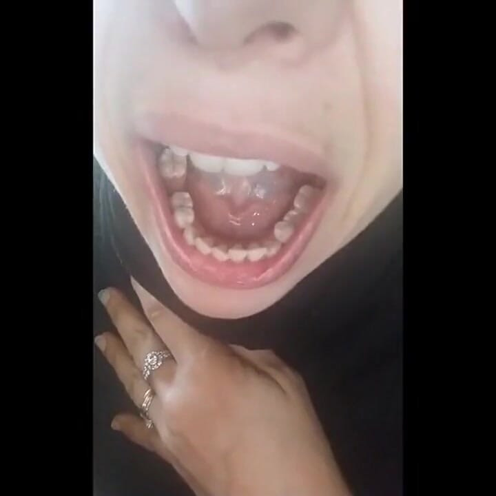 美丽的脸, 但腐烂的牙齿!