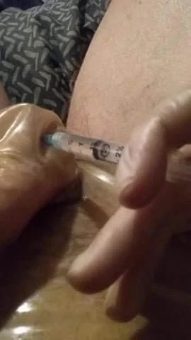 Latex injection