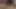 My Cum Is Coming Out of the Tip of My Penis