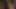 ボンデージ1