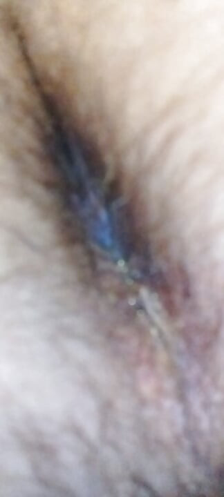 Urina, piss, all inclusive