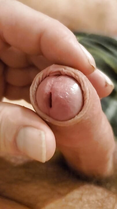 Wanking teasing my foreskin until I erupt