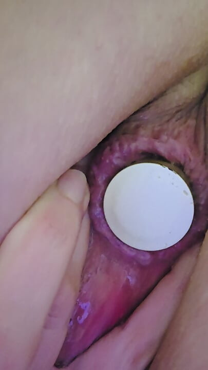 Close-up of a bottle inserted into the anus...
