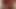 POV facial